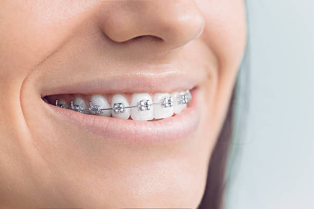 Full Mouth Reconstruction in Pinardville, NH